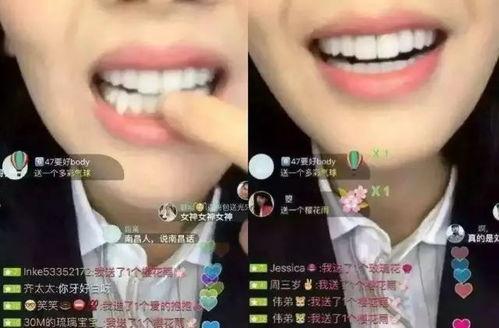 那些明星补牙,补牙前后大变身