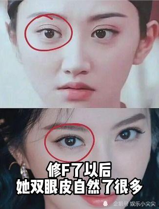 明星整容 分析,美丽背后的秘密与争议